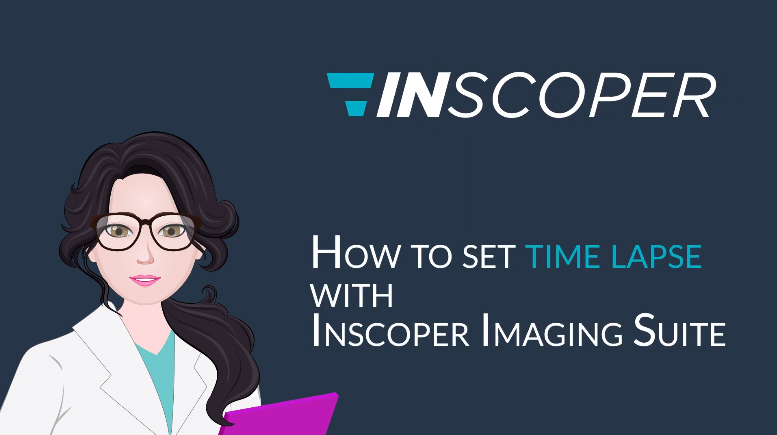 How to set time lapse