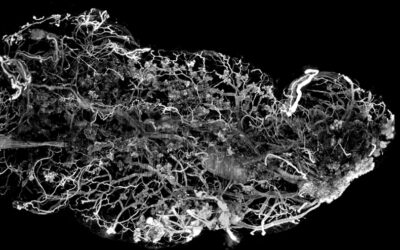 Imaging cleared organ with an Ultramacroscope using Inscoper Imaging Solution