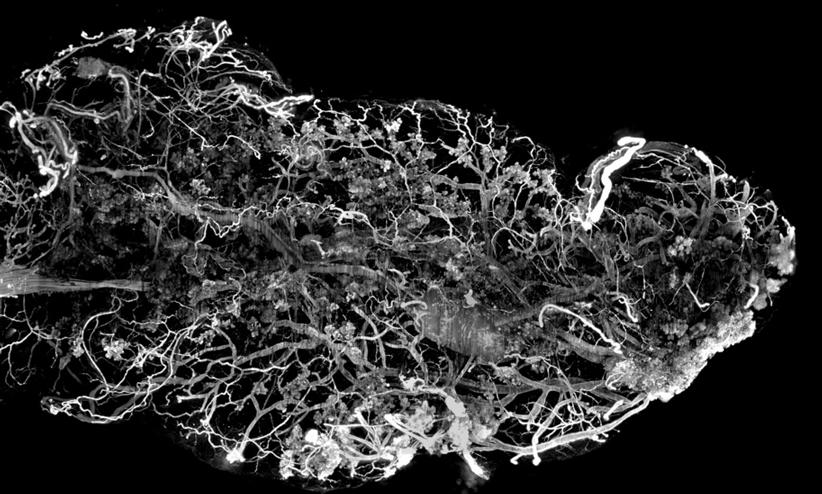 Imaging cleared organ with an Ultramacroscope using Inscoper Imaging Solution