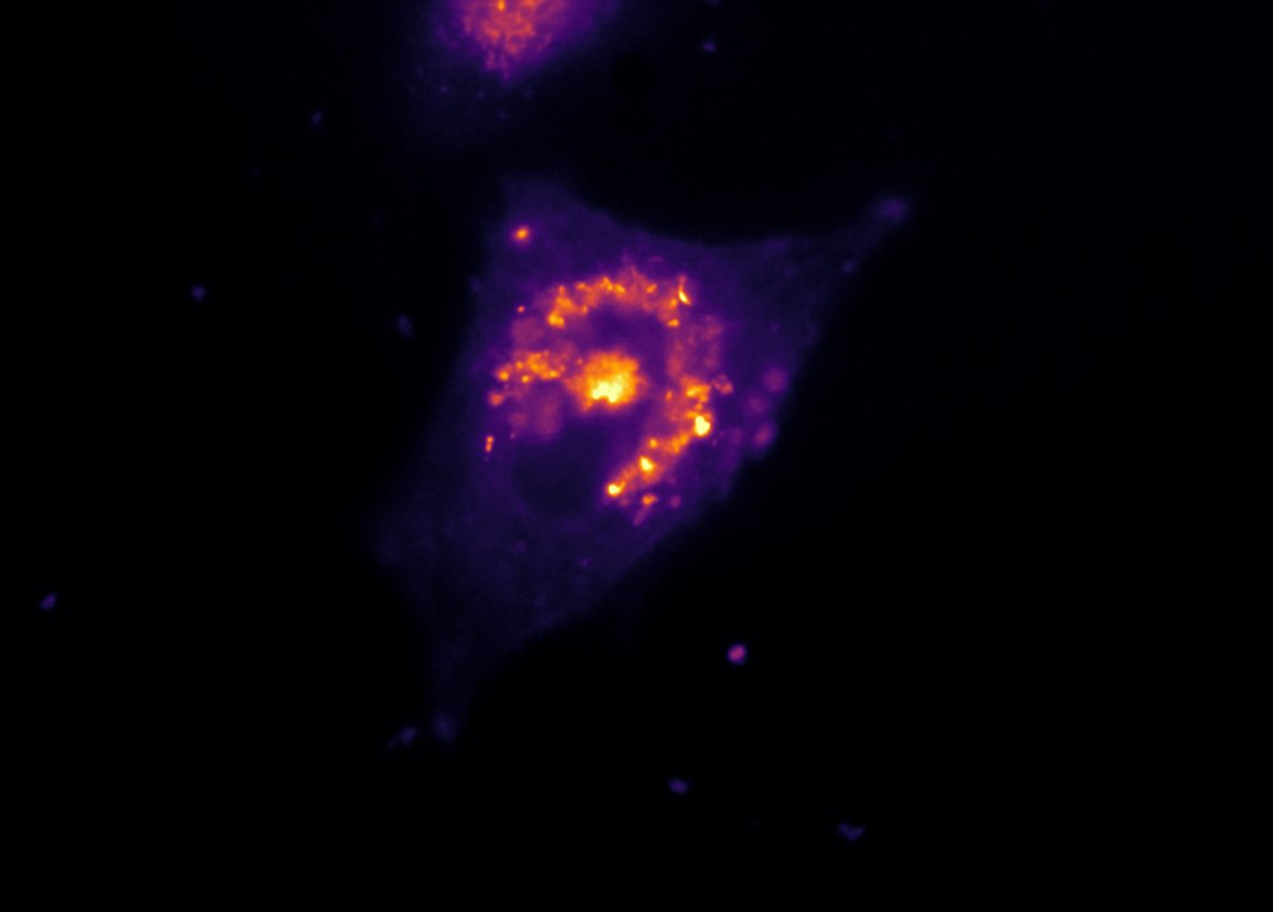 RE-YFP_FRAP_RawImage+Microvolution-1