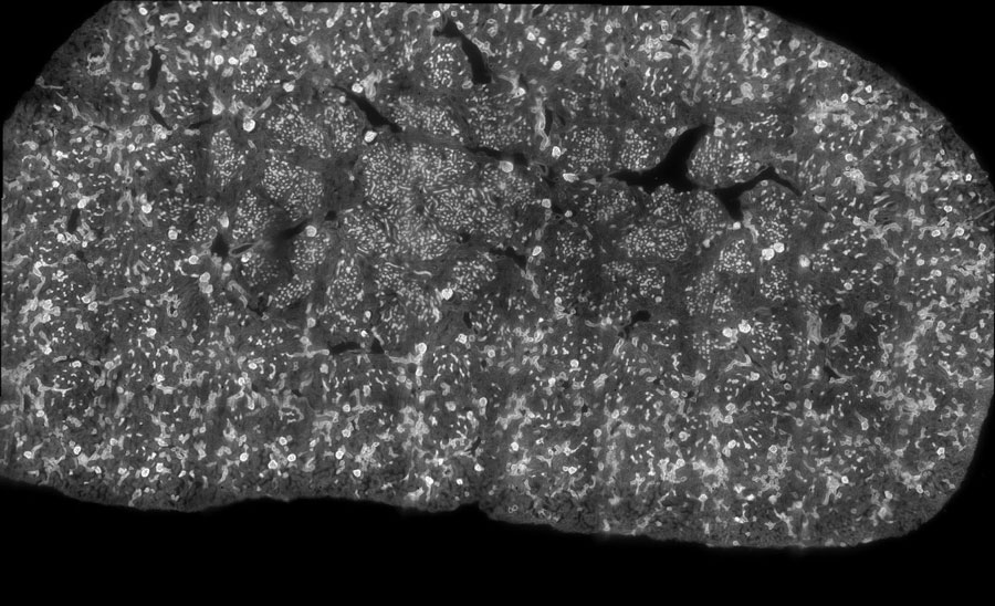 kidney-tiling-inscoper-zaber-nucleus