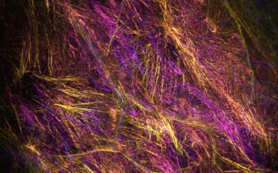 Overcome a paradoxical situation in a complex biological context using dynamic Random Illumination Microscopy