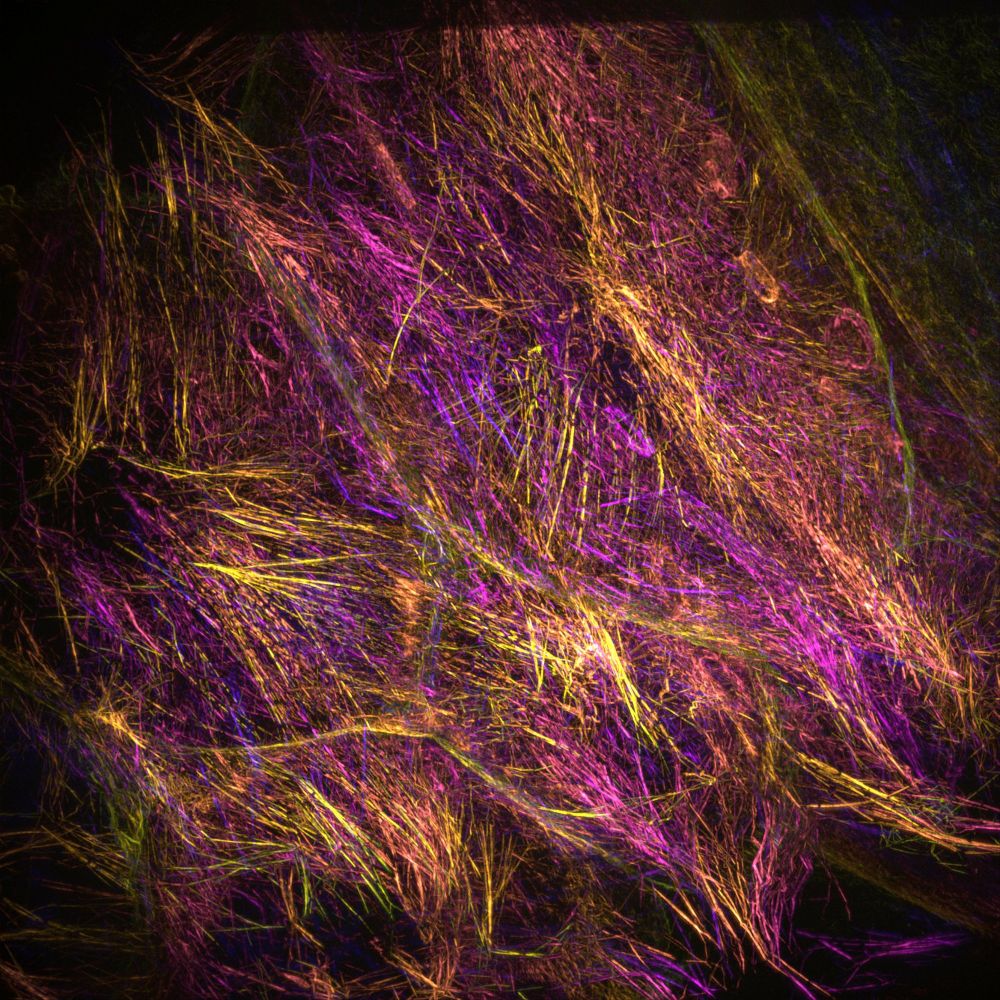 Biology image acquired with liveDRIM, dynamic super resolution microscopy