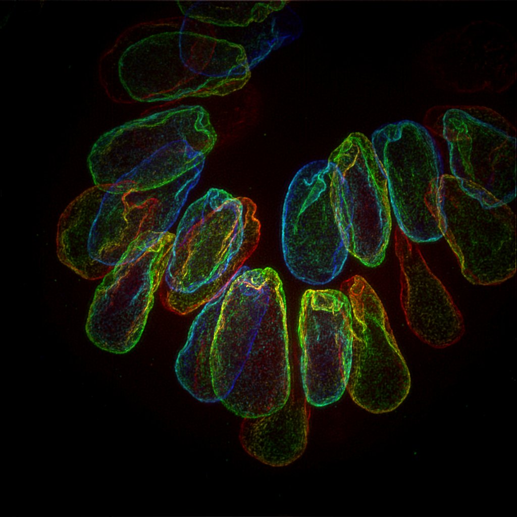 liveDRIm faster image acquisition sample