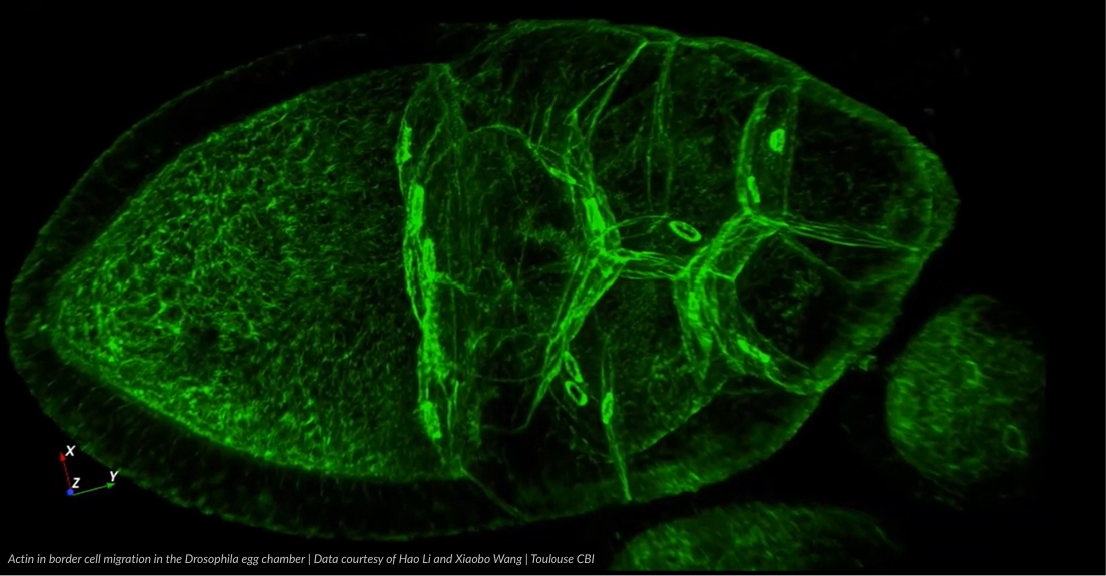 Drosophilia egg chamber imaged with liveDRIM