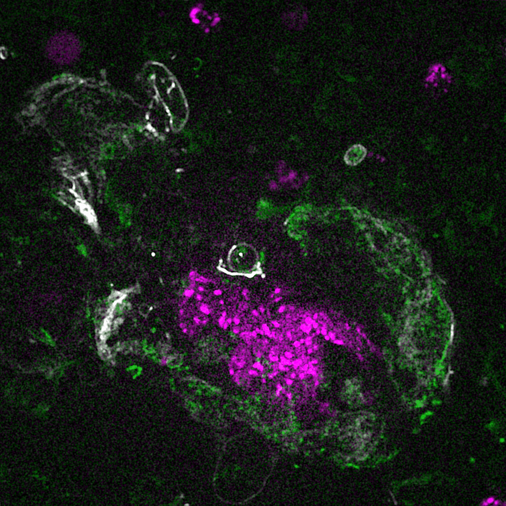 Mouse bone marrow megakaryocytes imaged by Random Illumination Microscopy, performed with liveDRIM. Claire Masson et Anita Eckly, EFS Strasbourg